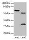 Zinc Finger Protein 384 antibody, LS-C211598, Lifespan Biosciences, Western Blot image 