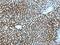 TSP3 antibody, 19727-1-AP, Proteintech Group, Immunohistochemistry paraffin image 