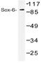 SRY-Box 6 antibody, AP20382PU-N, Origene, Western Blot image 