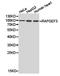 Rap Guanine Nucleotide Exchange Factor 3 antibody, TA327333, Origene, Western Blot image 