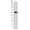 Transforming Growth Factor Beta Receptor 1 antibody, GTX00840, GeneTex, Western Blot image 