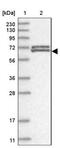 Zinc Finger Protein 8 antibody, NBP1-81754, Novus Biologicals, Western Blot image 