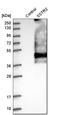 SS2R antibody, HPA007264, Atlas Antibodies, Western Blot image 