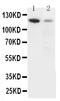 Integrin Subunit Alpha 3 antibody, GTX11993, GeneTex, Western Blot image 