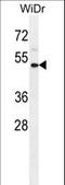 Interleukin 1 Receptor Type 2 antibody, LS-C165190, Lifespan Biosciences, Western Blot image 