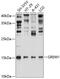 Gremlin-1 antibody, GTX66072, GeneTex, Western Blot image 