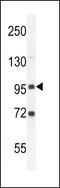 Glycosylphosphatidylinositol Specific Phospholipase D1 antibody, GTX82504, GeneTex, Western Blot image 