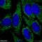 Lysosomal Associated Membrane Protein 2 antibody, 10397-1-AP, Proteintech Group, Immunofluorescence image 