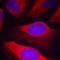 Inhibitor Of Nuclear Factor Kappa B Kinase Subunit Beta antibody, STJ22188, St John