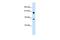 Protein Hunchback antibody, GTX46287, GeneTex, Western Blot image 