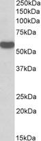 RNA 2',3'-Cyclic Phosphate And 5'-OH Ligase antibody, STJ72588, St John