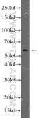 Catalase antibody, 21260-1-AP, Proteintech Group, Western Blot image 