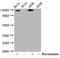 Janus Kinase 2 antibody, CSB-RA011931A100phHU, Cusabio, Western Blot image 