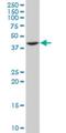 ST3 Beta-Galactoside Alpha-2,3-Sialyltransferase 4 antibody, H00006484-M01, Novus Biologicals, Western Blot image 