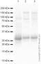 Troponin I3, Cardiac Type antibody, ab47003, Abcam, Western Blot image 