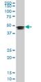 Homeobox protein Hox-D3 antibody, H00003232-M09, Novus Biologicals, Western Blot image 