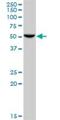 Histidyl-TRNA Synthetase antibody, H00003035-B01P, Novus Biologicals, Western Blot image 