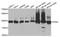 Phosphofructokinase, Muscle antibody, TA332713, Origene, Western Blot image 