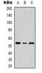Neurotensin Receptor 1 antibody, orb338853, Biorbyt, Western Blot image 