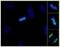 ZW10 Interacting Kinetochore Protein antibody, NB100-2364, Novus Biologicals, Immunocytochemistry image 