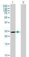 Coiled-Coil-Helix-Coiled-Coil-Helix Domain Containing 3 antibody, ab69328, Abcam, Western Blot image 