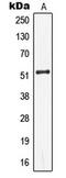 Keratin 13 antibody, LS-C352432, Lifespan Biosciences, Western Blot image 