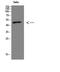 Interferon Regulatory Factor 3 antibody, STJ98960, St John