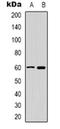 Calcium/Calmodulin Dependent Protein Kinase IV antibody, orb318920, Biorbyt, Western Blot image 