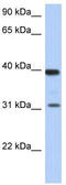 67 kDa laminin receptor antibody, TA335056, Origene, Western Blot image 