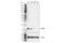 S100 Calcium Binding Protein A9 antibody, 72590S, Cell Signaling Technology, Western Blot image 