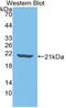 Interleukin 18 Binding Protein antibody, LS-C314320, Lifespan Biosciences, Western Blot image 