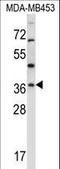Ring Finger Protein 144A antibody, LS-C162648, Lifespan Biosciences, Western Blot image 