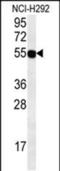 Zinc Finger Protein 492 antibody, PA5-48115, Invitrogen Antibodies, Western Blot image 