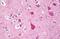 Endoplasmic Reticulum To Nucleus Signaling 1 antibody, MBS243697, MyBioSource, Immunohistochemistry paraffin image 