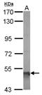 Aldehyde Dehydrogenase 5 Family Member A1 antibody, NBP1-32970, Novus Biologicals, Western Blot image 