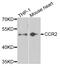 C-C Motif Chemokine Receptor 2 antibody, abx005872, Abbexa, Western Blot image 