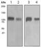 Integrin Subunit Beta 3 antibody, ab119992, Abcam, Western Blot image 