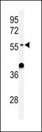 ATL3 antibody, LS-C156631, Lifespan Biosciences, Western Blot image 