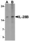 Interferon Lambda 3 antibody, PA5-72773, Invitrogen Antibodies, Western Blot image 