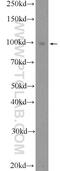 Progesterone Receptor antibody, 25871-1-AP, Proteintech Group, Western Blot image 