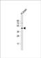 Gamma-Aminobutyric Acid Type A Receptor Rho3 Subunit (Gene/Pseudogene) antibody, PA5-48371, Invitrogen Antibodies, Western Blot image 