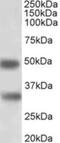 GTP Binding Protein Overexpressed In Skeletal Muscle antibody, NBP2-26121, Novus Biologicals, Western Blot image 