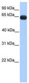 Zinc Finger Protein 100 antibody, TA341515, Origene, Western Blot image 