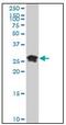 High Mobility Group Box 2 antibody, AM20899PU-N, Origene, Western Blot image 