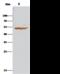 Aldehyde Dehydrogenase 3 Family Member A1 antibody, GTX02230, GeneTex, Immunoprecipitation image 