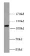Phosphatidylinositol-4,5-Bisphosphate 3-Kinase Catalytic Subunit Beta antibody, FNab06419, FineTest, Western Blot image 
