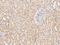 Acid Phosphatase antibody, GTX02234, GeneTex, Immunohistochemistry paraffin image 