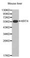 Keratin 4 antibody, abx002051, Abbexa, Western Blot image 