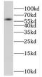 Fibronectin Type III And SPRY Domain Containing 1 Like antibody, FNab03229, FineTest, Western Blot image 