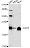 Gamma-glutamylcyclotransferase antibody, A06488, Boster Biological Technology, Western Blot image 